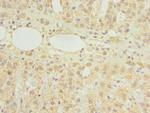 HDHD3 Antibody in Immunohistochemistry (Paraffin) (IHC (P))