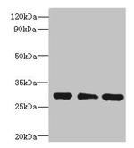 HDHD3 Antibody in Western Blot (WB)