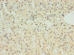 CLPB Polyclonal Antibody