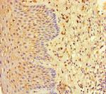 EHD1 Polyclonal Antibody