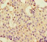 DHX33 Antibody in Immunohistochemistry (Paraffin) (IHC (P))