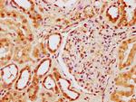 YY1AP1 Antibody in Immunohistochemistry (Paraffin) (IHC (P))