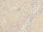 PSTPIP2 Polyclonal Antibody