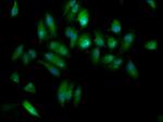 ELP3 Polyclonal Antibody