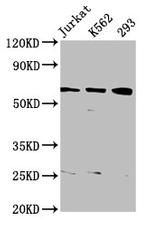 ELP3 Antibody in Western Blot (WB)