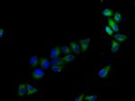 LRTM1 Polyclonal Antibody