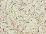 LRTM1 Antibody in Immunohistochemistry (Paraffin) (IHC (P))