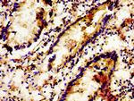 LGR6 Antibody in Immunohistochemistry (Paraffin) (IHC (P))