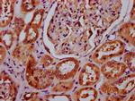 C20orf3 Antibody in Immunohistochemistry (Paraffin) (IHC (P))