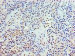 TrxR2 Antibody in Immunohistochemistry (Paraffin) (IHC (P))