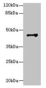DSCC1 Polyclonal Antibody