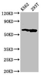 FAM83D Polyclonal Antibody