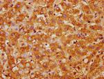 CK1 gamma-1 Antibody in Immunohistochemistry (Paraffin) (IHC (P))
