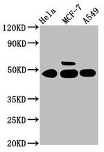 CK1 gamma-1 Antibody in Western Blot (WB)