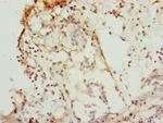 CK1 gamma-1 Antibody in Immunohistochemistry (Paraffin) (IHC (P))