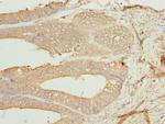 CK1 gamma-1 Polyclonal Antibody