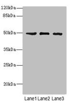 CK1 gamma-1 Antibody in Western Blot (WB)