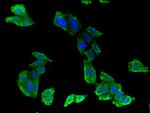 ABCB9 Polyclonal Antibody