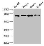 ABCB9 Antibody in Western Blot (WB)