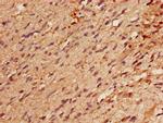 RBM22 Polyclonal Antibody