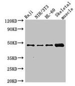 RBM22 Antibody in Western Blot (WB)