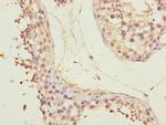 CEP72 Polyclonal Antibody