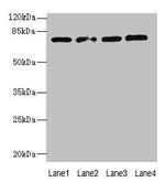 TBC1D14 Antibody in Western Blot (WB)