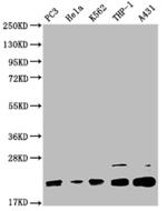 VPS29 Polyclonal Antibody