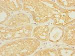 ASIC3 Polyclonal Antibody