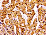NPC1 Polyclonal Antibody