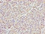 PACSIN2 Polyclonal Antibody