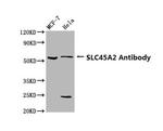 SLC45A2 Polyclonal Antibody