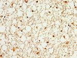 WASF3 Antibody in Immunohistochemistry (Paraffin) (IHC (P))