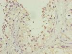 HOOK1 Antibody in Immunohistochemistry (Paraffin) (IHC (P))