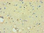 FBXW11 Antibody in Immunohistochemistry (Paraffin) (IHC (P))