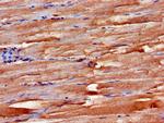 FBXW2 Antibody in Immunohistochemistry (Paraffin) (IHC (P))