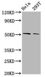 PLAGL2 Polyclonal Antibody