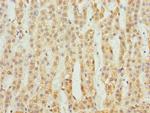 ACSL6 Polyclonal Antibody