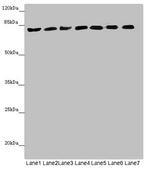 ACSL6 Antibody in Western Blot (WB)
