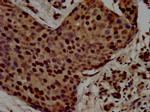 RALY Antibody in Immunohistochemistry (Paraffin) (IHC (P))