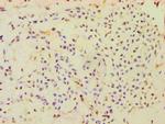 CBLC Antibody in Immunohistochemistry (Paraffin) (IHC (P))