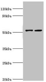 CBLC Antibody in Western Blot (WB)