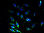 SSR3 Polyclonal Antibody