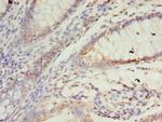 SSR3 Antibody in Immunohistochemistry (Paraffin) (IHC (P))