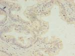 SSR3 Antibody in Immunohistochemistry (Paraffin) (IHC (P))