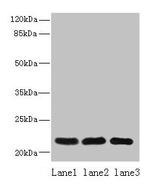SSR3 Antibody in Western Blot (WB)