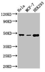 PACSIN3 Antibody in Western Blot (WB)