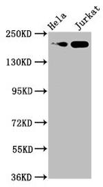 MYH2 Polyclonal Antibody