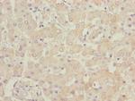 B9D1 Polyclonal Antibody