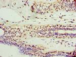 AP1M2 Antibody in Immunohistochemistry (Paraffin) (IHC (P))
